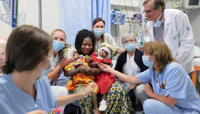 Two Central African conjoined twins joined together in Rome