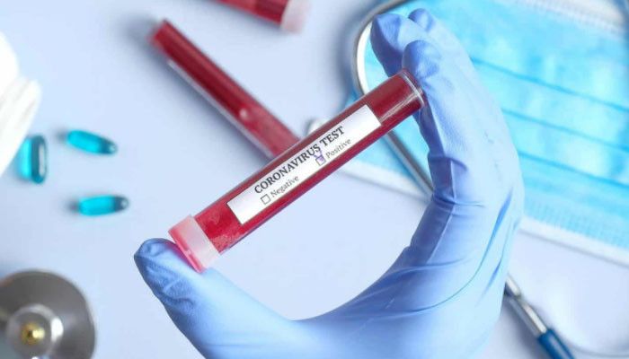В Грузии за сутки выявили 23 носителя коронавируса
