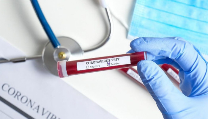 За сутки в Армении выявлено 543 новых случая коронавируса, скончались 6 человек