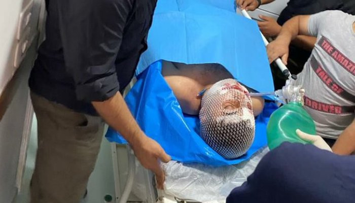 Ծանր վիրավորվել է «Համզայի»՝ Ադրբեջանի համար զինյալներ հավաքագրող պարագլուխը