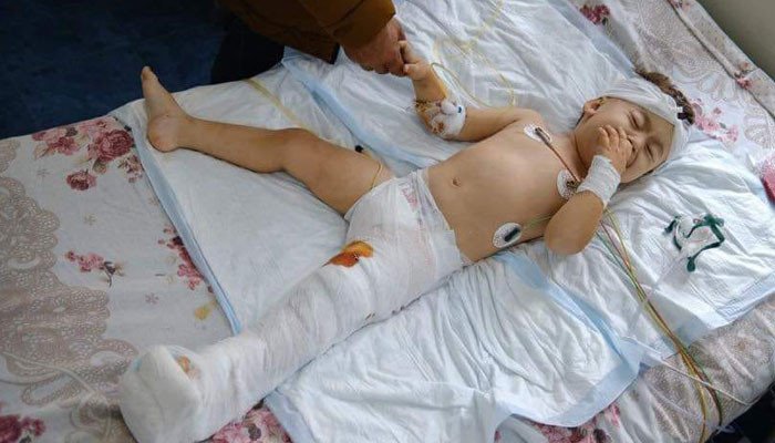 «Մարտունիում ծանր ռմբակոծությունից վիրավորված 2-ամյա Արծվիկը վիրահատվել է». Գևորգ Դերձյան
