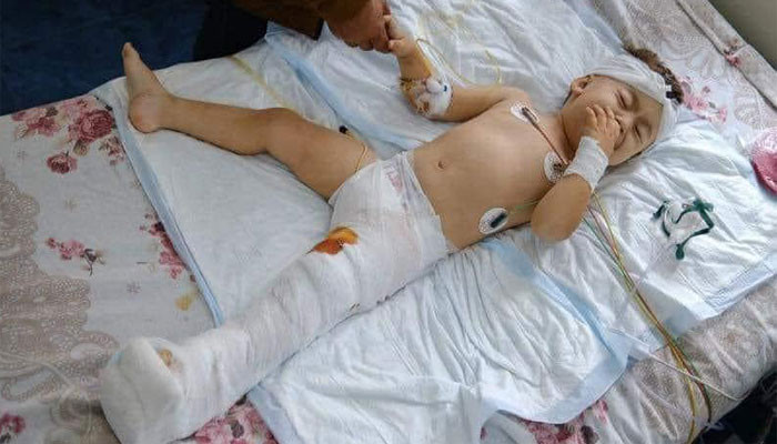 «2 ամյա Արծվիկը վիրահատվել է, նրա կյանքին վտանգ չի սպառնում». Արմեն Մուրադյան