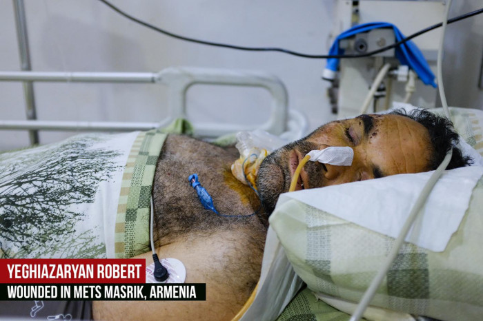 Սեպտեմբերի 27-ից ի վեր ադրբեջանական ագրեսիայի հետևանքով վիրավորում է ստացել ավելի քան 100 քաղաքացիական անձ