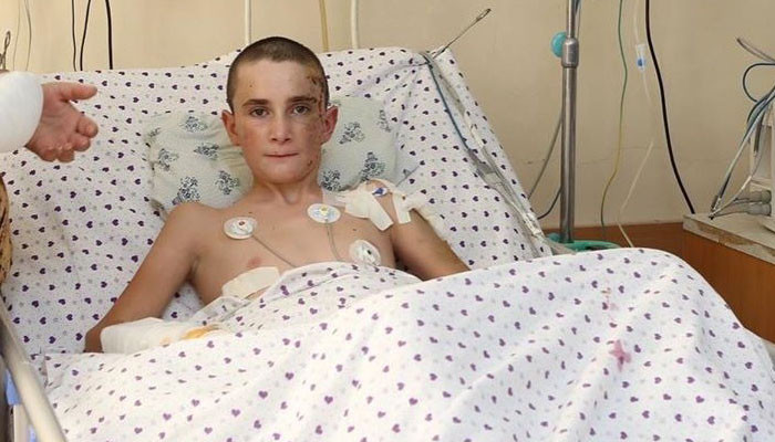 Ծայրահեղ ծանր վիճակում հոսպիտալացված 13-ամյա Ռոբերտը դուրս է գրվել վերակենդանացման բաժանմունքից