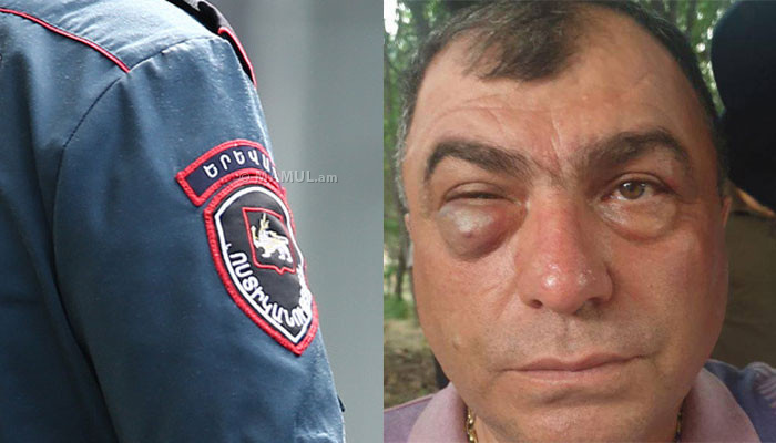 «Հայաստան» դաշինքի ներկայացուցչին ծեծել է բանգլադեշցի Կարենը՝ Եղեգնաձորի ոստիկանների հետ միասին