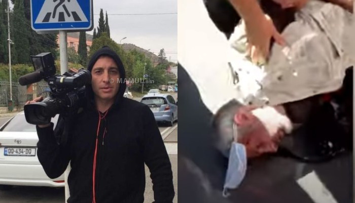 Умер оператор, которого жестоко избили на акции в Тбилиси 5 июля