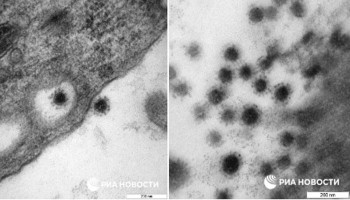 Опубликовано фото дельта-штамма коронавируса