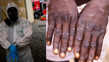 WHO confirms 780 monkeypox cases reported in 27 countries