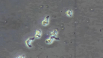 South Korea reports first death from ‘brain-eating amoeba’